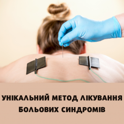 Внутрішньотканинна електростимуляції (ВТЕС) 207f7f0a90 - зображення 1
